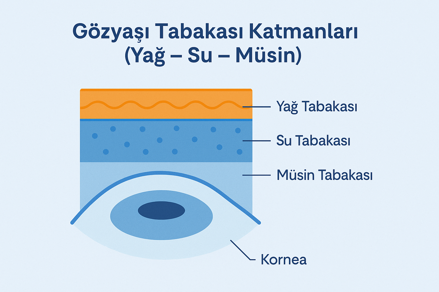 Gözyaşı tabakası katmanlarını gösteren ve göz kuruluğu nedenlerini açıklayan diyagram: yağ, su ve müsin tabakası
