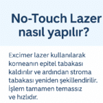 No-Touch Lazerin uygulanış adımlarını özetleyen açıklayıcı görsel