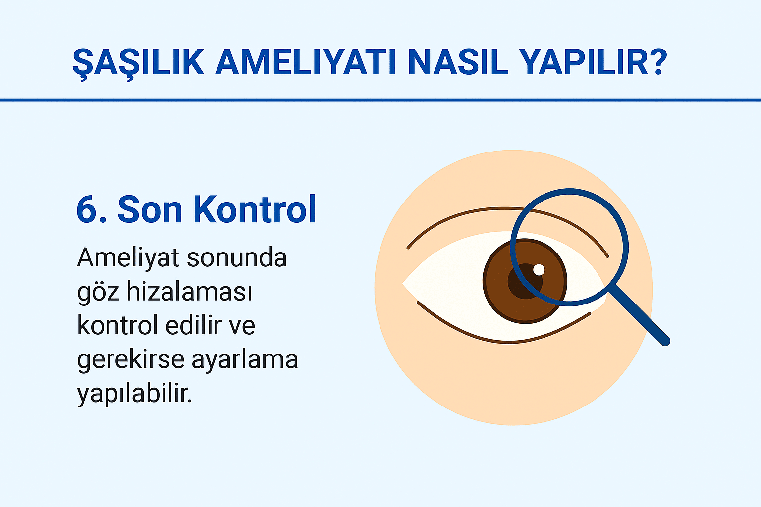 Ameliyat sonunda göz hizalamasının kontrol edildiğini gösteren son adım grafiği